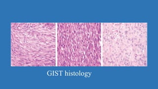 Gist Microscope GASTRO INTESTINAL STROMAL TUMOR (GIST) SURGERY | PPTX