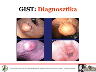 GIST:  Diagn osztika 