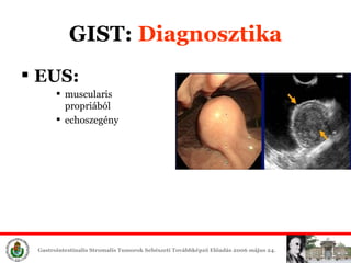 GIST:  Diagn osztika EUS : m uscularis propri ából echoszegény   
