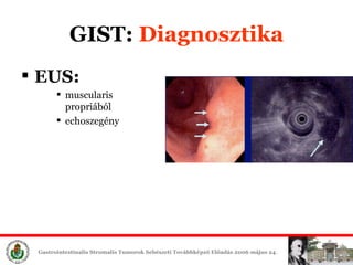 GIST:  Diagn osztika EUS : m uscularis propri ából echoszegény   