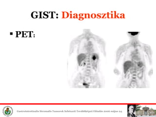 GIST:  Diagn osztika PET : 
