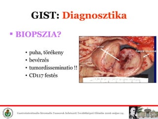 GIST:  Diagn osztika BIOPSZIA? puha, törékeny bevérzés tumordisseminatio !! CD117 festés 