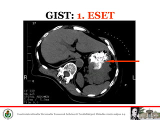 GIST:  1. ESET 