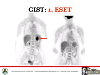 GIST:  1. ESET 
