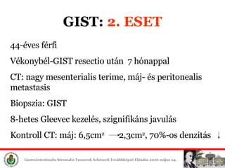 GIST:  2. ESET 44-éves férfi  Vékonybél-GIST resectio után  7 hónappal CT: nagy mesenterialis terime, máj- és peritonealis   metastasis Biopszia: GIST 8-hetes Gleevec é, szignifikáns javulás Kontroll CT: máj: 6,5cm 2   2,3cm 2 , 70%-os denzitás   