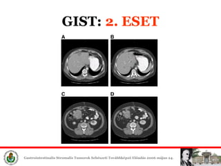 GIST:  2. ESET 