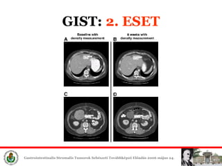 GIST:  2. ESET 
