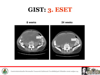 GIST:  3. ESET 