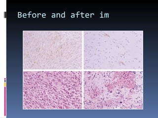 Before and after im 