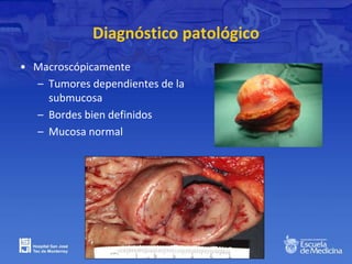 Diagnóstico patológico
• Macroscópicamente
– Tumores dependientes de la
submucosa
– Bordes bien definidos
– Mucosa normal
 