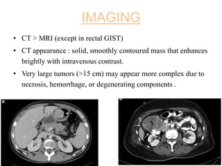 IMAGING
• CT > MRI (except in rectal GIST)
• CT appearance : solid, smoothly contoured mass that enhances
brightly with intravenous contrast.
• Very large tumors (>15 cm) may appear more complex due to
necrosis, hemorrhage, or degenerating components .
 