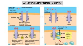 Gastrointestinal stromal tumors (GIST).pptx