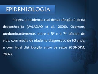 Porém, a incidência real dessa afecção é ainda
desconhecida (VALADÃO et al., 2006). Ocorrem,
predominantemente, entre a 5ª e a 7ª década de
vida, com média de idade no diagnóstico de 60 anos,
e com igual distribuição entre os sexos (GONDIM,
2009).
 