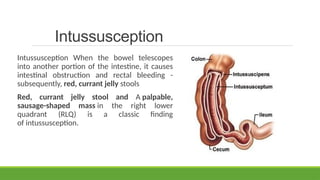 GI surgical emergencies in newborn-SUJATA | PPTX