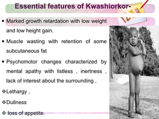 Essential features of Kwashiorkor-
 Marked growth retardation with low weight
and low height gain.
 Muscle wasting with retention of some
subcutaneous fat
 Psychomotor changes characterized by
mental apathy with listless , inertness ,
lack of interest about the surrounding ,
Lethargy ,
Dullness
 loss of appetite.
 