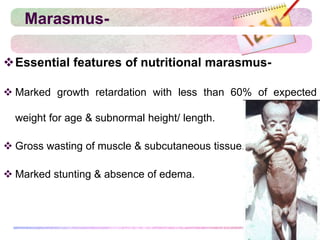 Marasmus-
Essential features of nutritional marasmus-
 Marked growth retardation with less than 60% of expected
weight for age & subnormal height/ length.
 Gross wasting of muscle & subcutaneous tissue.
 Marked stunting & absence of edema.
 