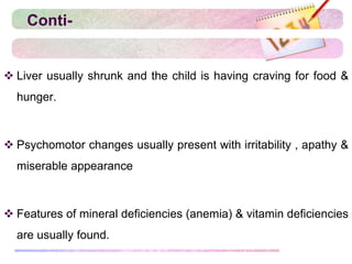 Conti-
 Liver usually shrunk and the child is having craving for food &
hunger.
 Psychomotor changes usually present with irritability , apathy &
miserable appearance
 Features of mineral deficiencies (anemia) & vitamin deficiencies
are usually found.
 