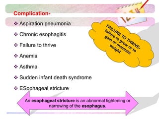 Complication-
 Aspiration pneumonia
 Chronic esophagitis
 Failure to thrive
 Anemia
 Asthma
 Sudden infant death syndrome
 ESophageal stricture
An esophageal stricture is an abnormal tightening or
narrowing of the esophagus.
 