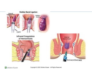 Copyright © 2022 Wolters Kluwer · All Rights Reserved
 