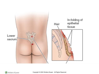 Copyright © 2022 Wolters Kluwer · All Rights Reserved
 