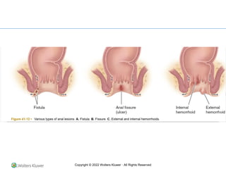 Copyright © 2022 Wolters Kluwer · All Rights Reserved
 