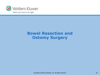 Copyright © 2014 Wolters Kluwer Health | Lippincott Williams & Wilkins
Bowel Resection and
Ostomy Surgery
Copyright © 2020 by Elsevier, Inc. All rights reserved. 30
 