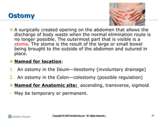 Copyright © 2022 Wolters Kluwer · All Rights Reserved
❖ A surgically created opening on the abdomen that allows the
discharge of body waste when the normal elimination route is
no longer possible. The outermost part that is visible is a
stoma. The stoma is the result of the large or small bowel
being brought to the outside of the abdomen and sutured in
place.
❖ Named for location:
1. An ostomy in the Ileum—ileostomy (involuntary drainage)
2. An ostomy in the Colon—colostomy (possible regulation)
❖ Named for Anatomic site: ascending, transverse, sigmoid
- May be temporary or permanent.
Ostomy
Copyright © 2020 by Elsevier, Inc. All rights reserved. 32
 