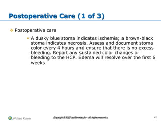 Copyright © 2022 Wolters Kluwer · All Rights Reserved
❖ Postoperative care
▪ A dusky blue stoma indicates ischemia; a brown-black
stoma indicates necrosis. Assess and document stoma
color every 4 hours and ensure that there is no excess
bleeding. Report any sustained color changes or
bleeding to the HCP. Edema will resolve over the first 6
weeks
Postoperative Care (1 of 3)
Copyright © 2020 by Elsevier, Inc. All rights reserved. 41
 