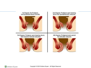 Copyright © 2022 Wolters Kluwer · All Rights Reserved
 