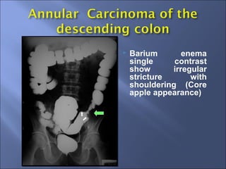 GIT Imaging for Medical Students | PPT