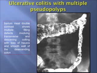GIT Imaging for Medical Students | PPT