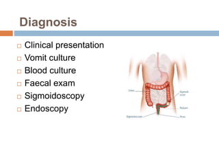 Diagnosis
 Clinical presentation
 Vomit culture
 Blood culture
 Faecal exam
 Sigmoidoscopy
 Endoscopy
 