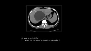 11 years old child
What is the most probable diagnosis ?
 