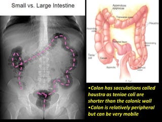 •Colon has sacculations called
haustra as teniae coli are
shorter than the colonic wall
•Colon is relatively peripheral
but can be very mobile
 