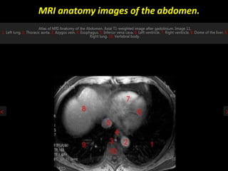 MRI anatomy images of the abdomen.
 