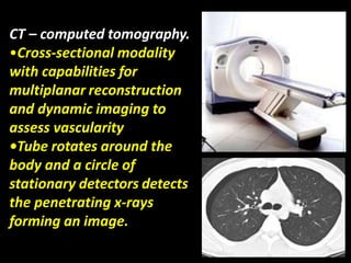 CT – computed tomography.
•Cross-sectional modality
with capabilities for
multiplanar reconstruction
and dynamic imaging to
assess vascularity
•Tube rotates around the
body and a circle of
stationary detectors detects
the penetrating x-rays
forming an image.
 
