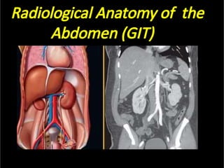 Radiological Anatomy of the
Abdomen (GIT)
 