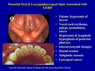 Potential Oral & Laryngopharyngeal Signs Associated with GERD Edema /hyperemia of larynx Vocal cord erythema, polyps, granulomas, ulcers Hyperemia & lymphoid hyperplasia of posterior pharynx  Interarytenyoid changes Dental erosion Subglottic stenosis Laryngeal cancer Vaezi MF, Hicks DM, Abelson TI, Richter JE. Clin Gastro Hep 2003;1:333-344. 