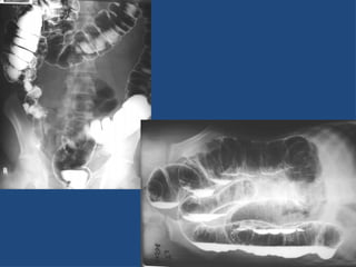 git-radiology- introduction to medical students.pptx