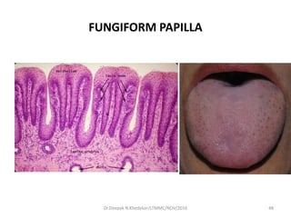 FUNGIFORM PAPILLA
Dr.Deepak N.Khedekar/LTMMC/NOV/2016 48
 