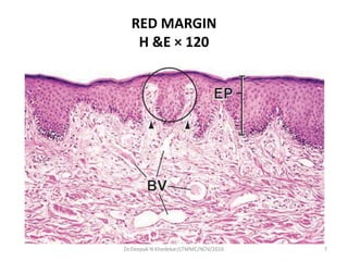 RED MARGIN
H &E × 120
7Dr.Deepak N.Khedekar/LTMMC/NOV/2016
 