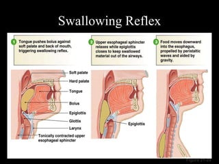 Figure 21-24
Swallowing Reflex
126
 