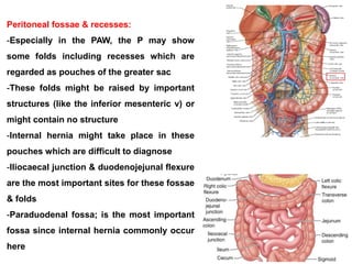 Peritoneal fossae & recesses:
-Especially in the PAW, the P may show
some folds including recesses which are
regarded as pouches of the greater sac
-These folds might be raised by important
structures (like the inferior mesenteric v) or
might contain no structure
-Internal hernia might take place in these
pouches which are difficult to diagnose
-Iliocaecal junction & duodenojejunal flexure
are the most important sites for these fossae
& folds
-Paraduodenal fossa; is the most important
fossa since internal hernia commonly occur
here
 