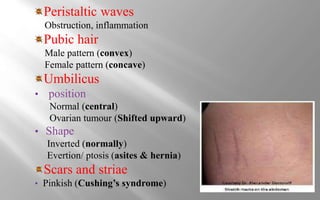 Peristaltic waves
Obstruction, inflammation
Pubic hair
Male pattern (convex)
Female pattern (concave)
Umbilicus
• position
Normal (central)
Ovarian tumour (Shifted upward)
• Shape
Inverted (normally)
Evertion/ ptosis (asites & hernia)
Scars and striae
• Pinkish (Cushing’s syndrome)
 