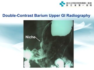Niche
Double-Contrast Barium Upper GI Radiography
 