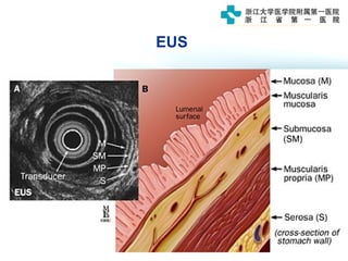 EUS
 