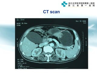 CT scan
 
