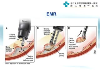 EMR
 