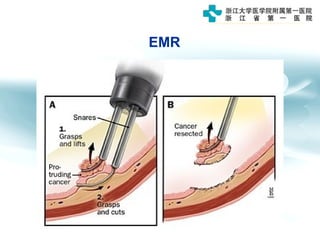EMR
 