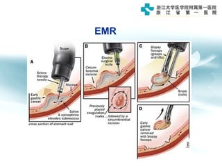 EMR
 